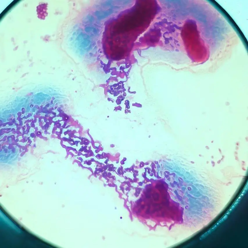Examen Microscopic pe Frotiu Colorat: Tehnica și Importanța Diagnosticului